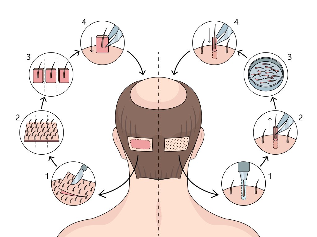 shutterstock_2473894207 [Converted].jpg